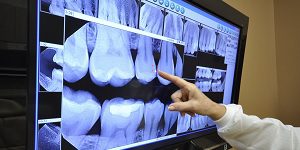 Dental Exam and X-Rays