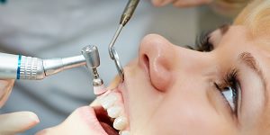 Prophylaxis (Teeth Cleaning)