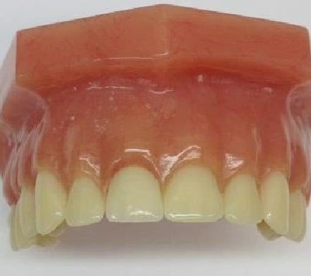 dental-impant-finish